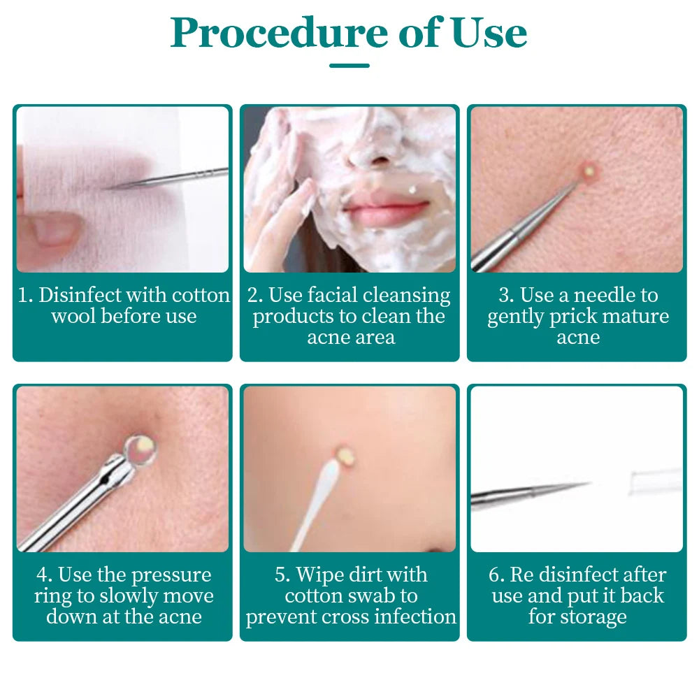 5/8PCS Acne Blackhead Removal Needles Cleansing Tool Beauty