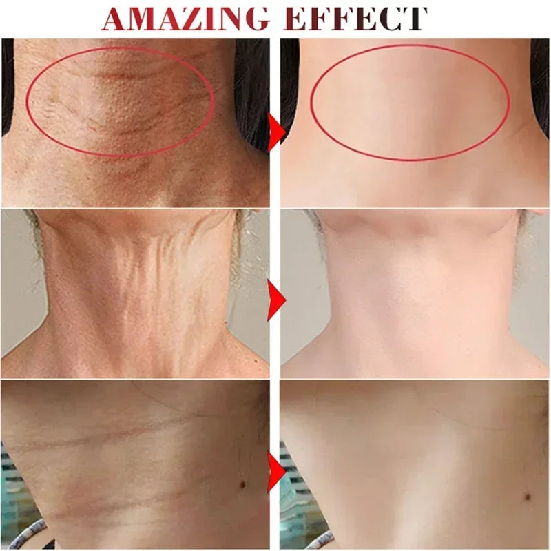 Neck Firming Wrinkle Remover Cream Rejuvenation Lift Firme