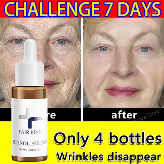 Retinol Wrinkles Remover Face Serum Lifting Firming Anti Aging Essence Fade Fine Lines Moisturizing Brightening Beauty Skin Care