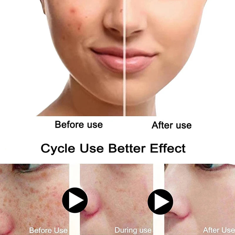 Turmeric Freckle Whitening Serum Fade Dark Spots Removal Pigment Melanin Correcting Facial Beauty Face Skin Care Products 30ml
