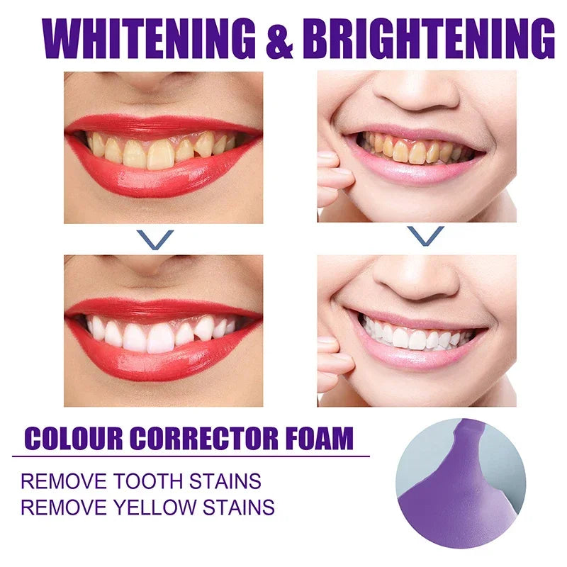 50ml V34 Mousse Toothpaste Teeth Whitening
