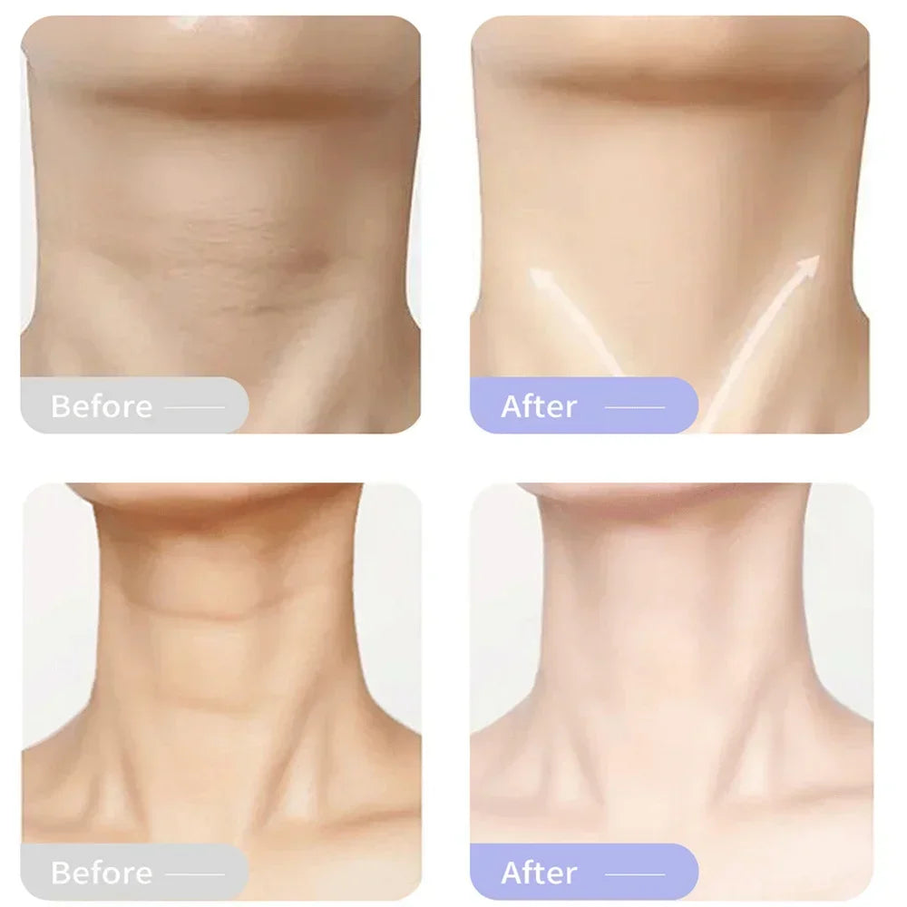 Neck Firming Wrinkle Remover Cream Rejuvenation Lift Firme