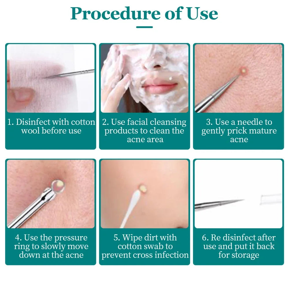Blackhead Acne Needle Cell Pimples Blackhead Clip