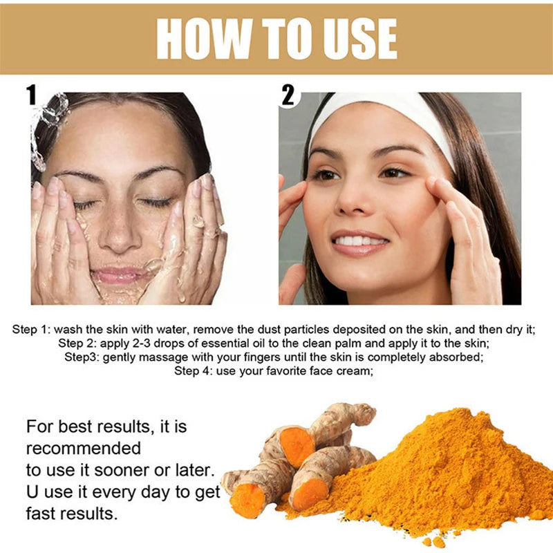 Turmeric Freckle Whitening Serum Fade Dark Spots Removal Pigment Melanin Correcting Facial Beauty Face Skin Care Products 30ml