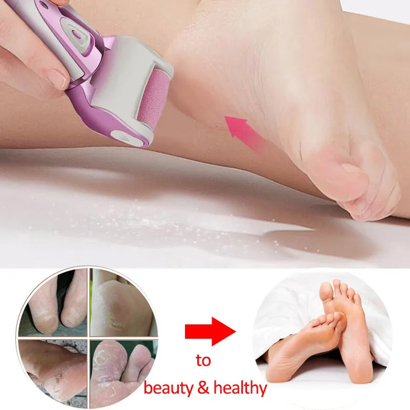 Denicer electric foot care machine hard dry