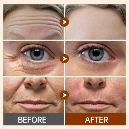 Wrinkle Retinol Face Cream Vitamin E Fine Lines Removal Hyaluronic Acid Moisturizing Lifting Aging Facial Cream Skin Care Beauty