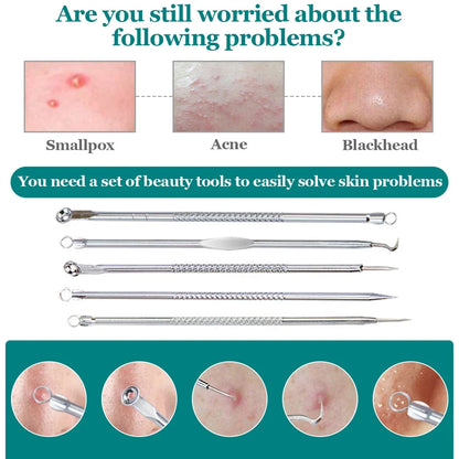 Blackhead Acne Needle Cell Pimples Blackhead Clip