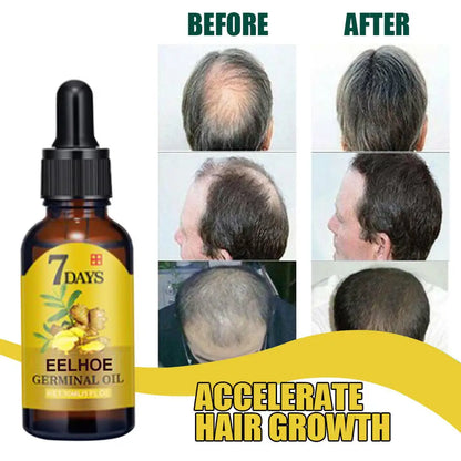 Hair Growth Serum Fast Growing Hair