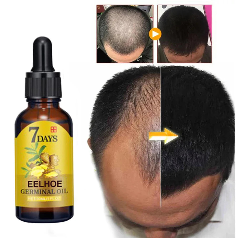 Hair Growth Serum Fast Growing Hair