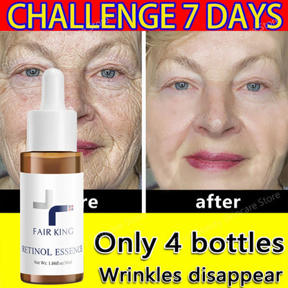 Retinol Wrinkles Remover Face Serum Lifting Firming Anti Aging Essence Fade Fine Lines Moisturizing Brightening Beauty Skin Care
