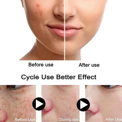 Turmeric Freckle Whitening Serum Fade Dark Spots Removal Pigment Melanin Correcting Facial Beauty Face Skin Care Products 30ml