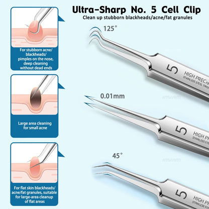 German Ultra-fine No. 5 Cell Pimples Black Cleaning Acne Wart Skin Care Tools