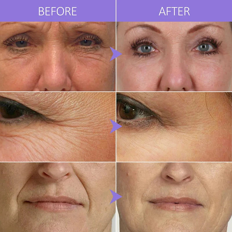 Collagen Face Serum Wrinkle Removal Anti Aging