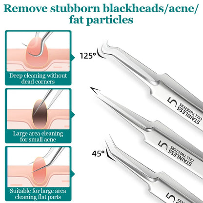 Blackhead Acne Needle Cell Pimples Blackhead Clip