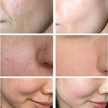 Lactobionic Acid Serum Shrink Pores