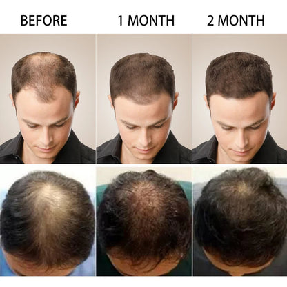 Hair Growth Serum Fast Growing Hair