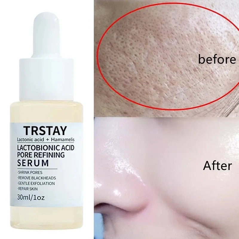 Lactobionic Acid Serum Shrink Pores