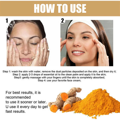 Turmeric Freckle Whitening Serum Fade Dark Spots Removal Pigment Melanin Correcting Facial Beauty Face Skin Care Products 30ml